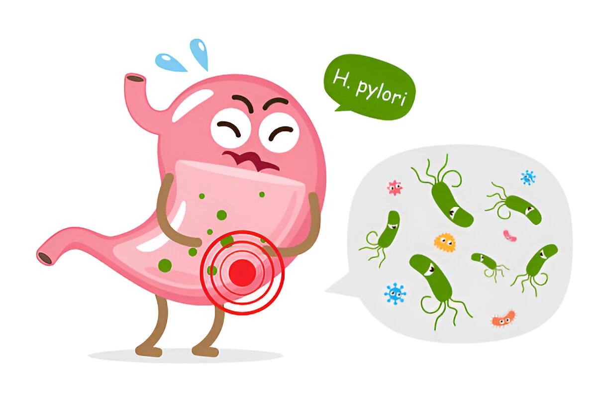 INFEKSI HELICOBACTER PYLORI: PENYEBAB, GEJALA DAN CARA MENGATASINYA