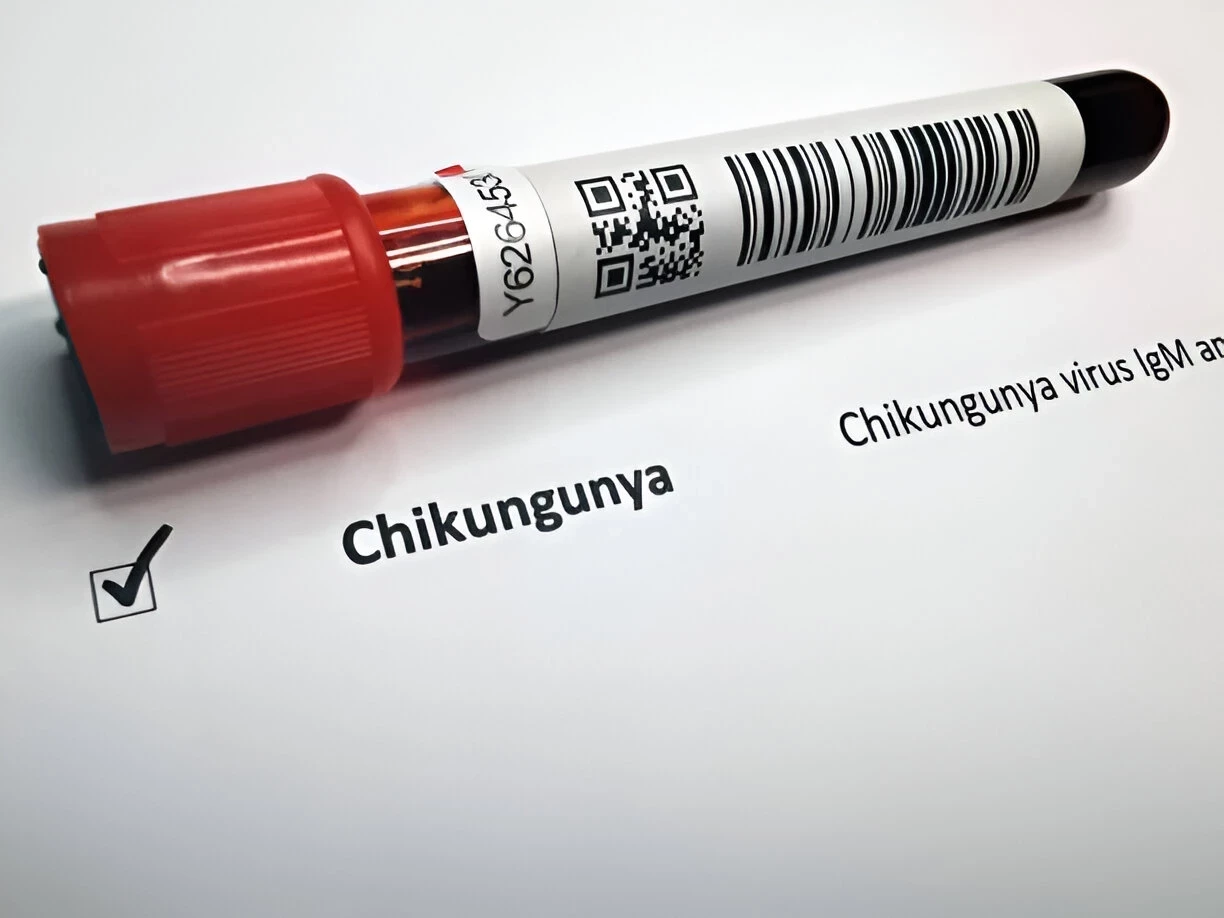 CHIKUNGUNYA: PENYEBAB, GEJALA DAN CARA MENCEGAHNYA