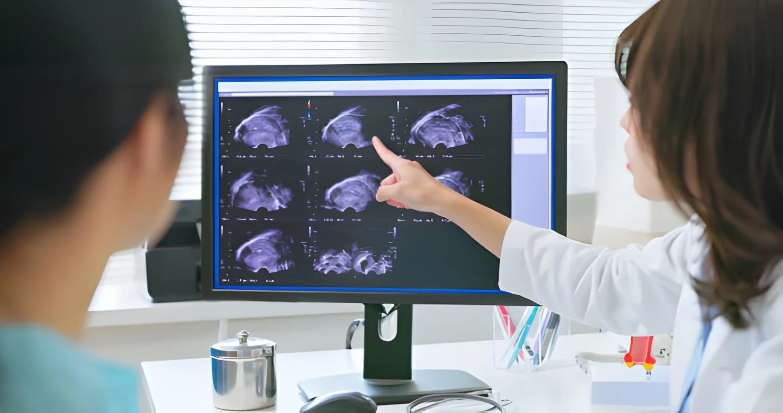 Anensefali: Penyebab, Gejala, Diagnosis dan Cara Mencegahnya