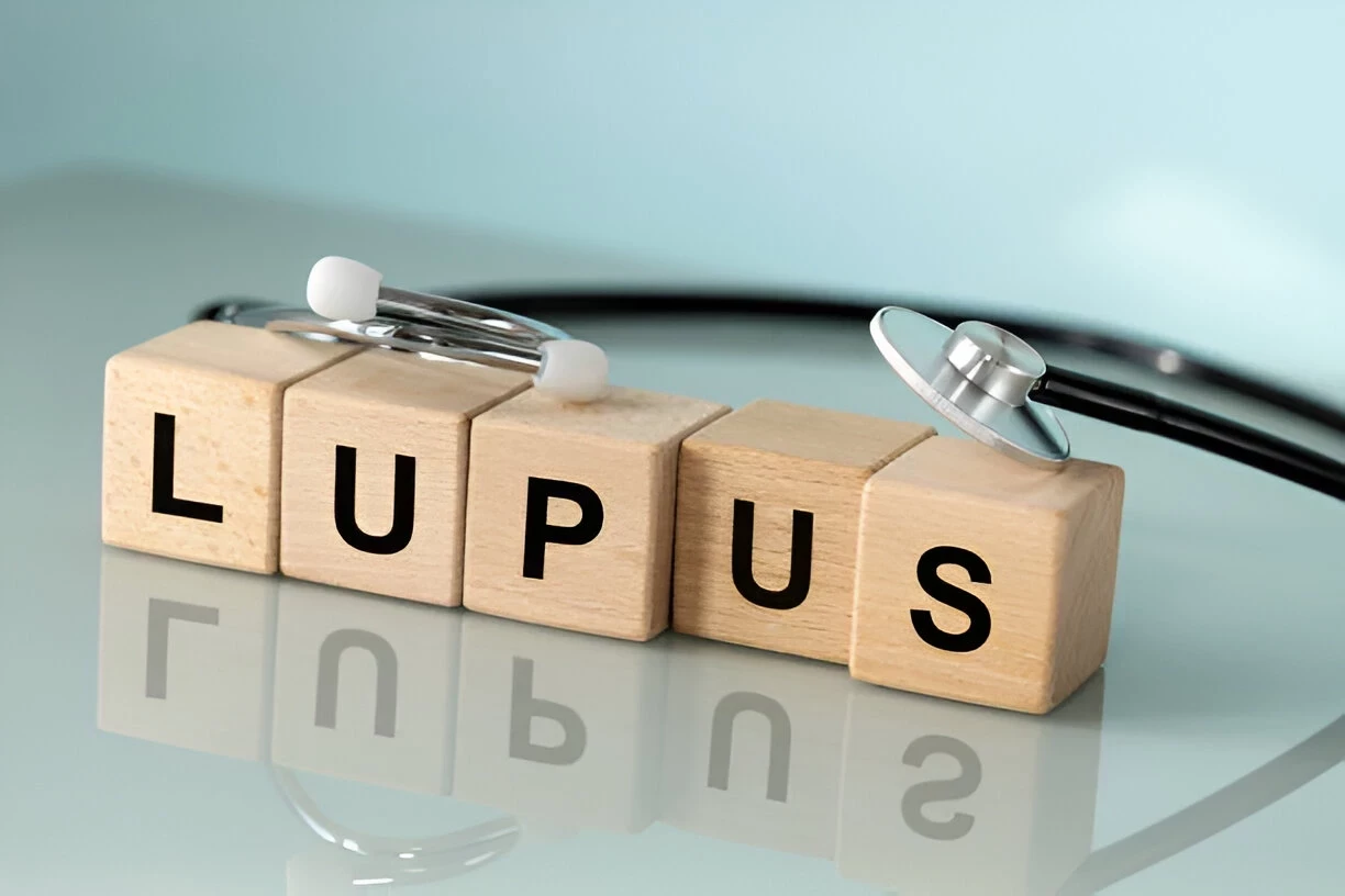Mengenal Lupus: Penyakit Autoimun Yang Perlu Diwaspadai
