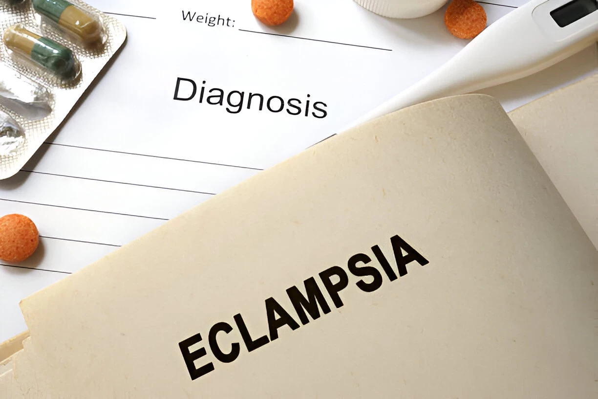 Eklamsia: Penyebab, Gejala dan Cara Mengatasinya