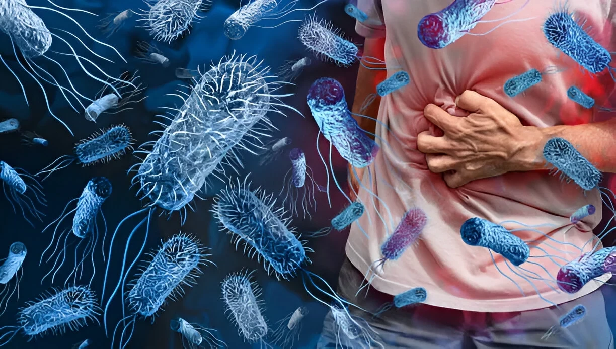 Keracunan Makanan (Food Poisoning): Penyebab, Gejala, dan Cara Mengatasinya