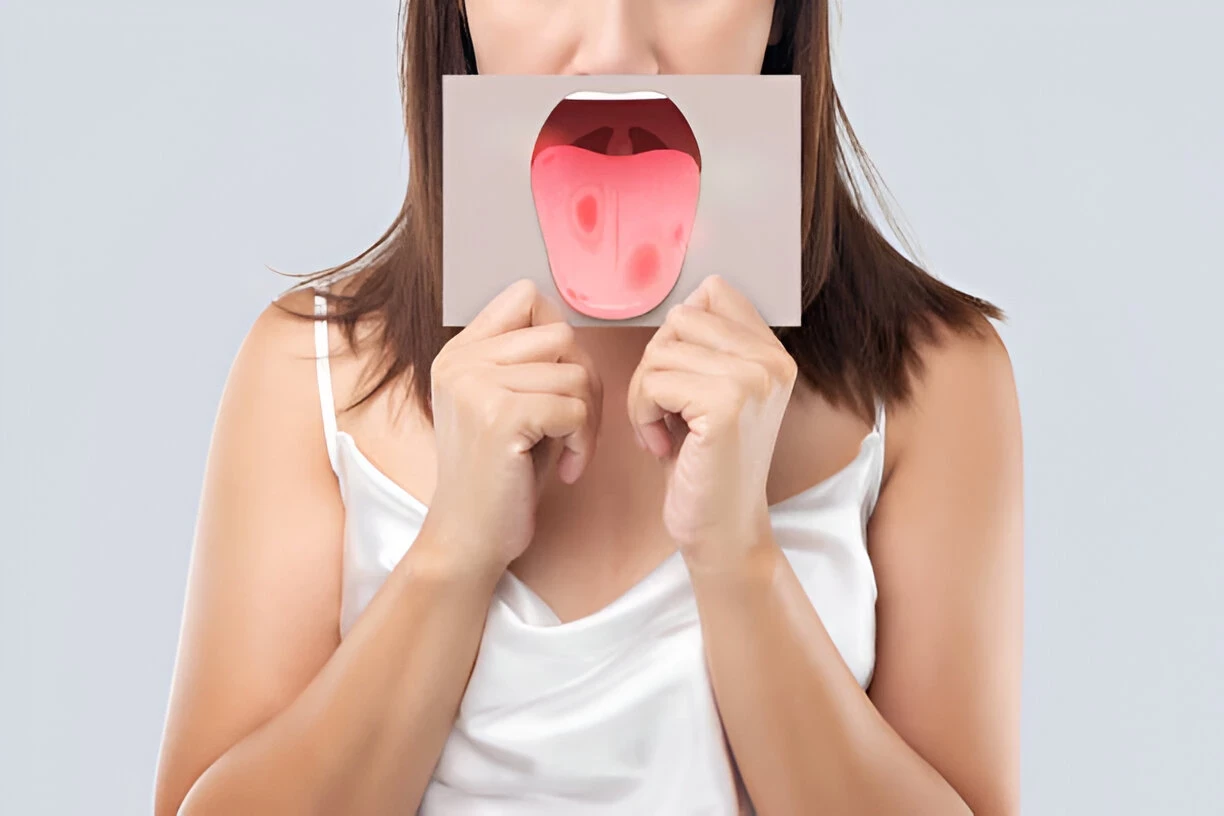 Leukoplakia: Penyebab, Gejala, dan Cara Mengobatinya