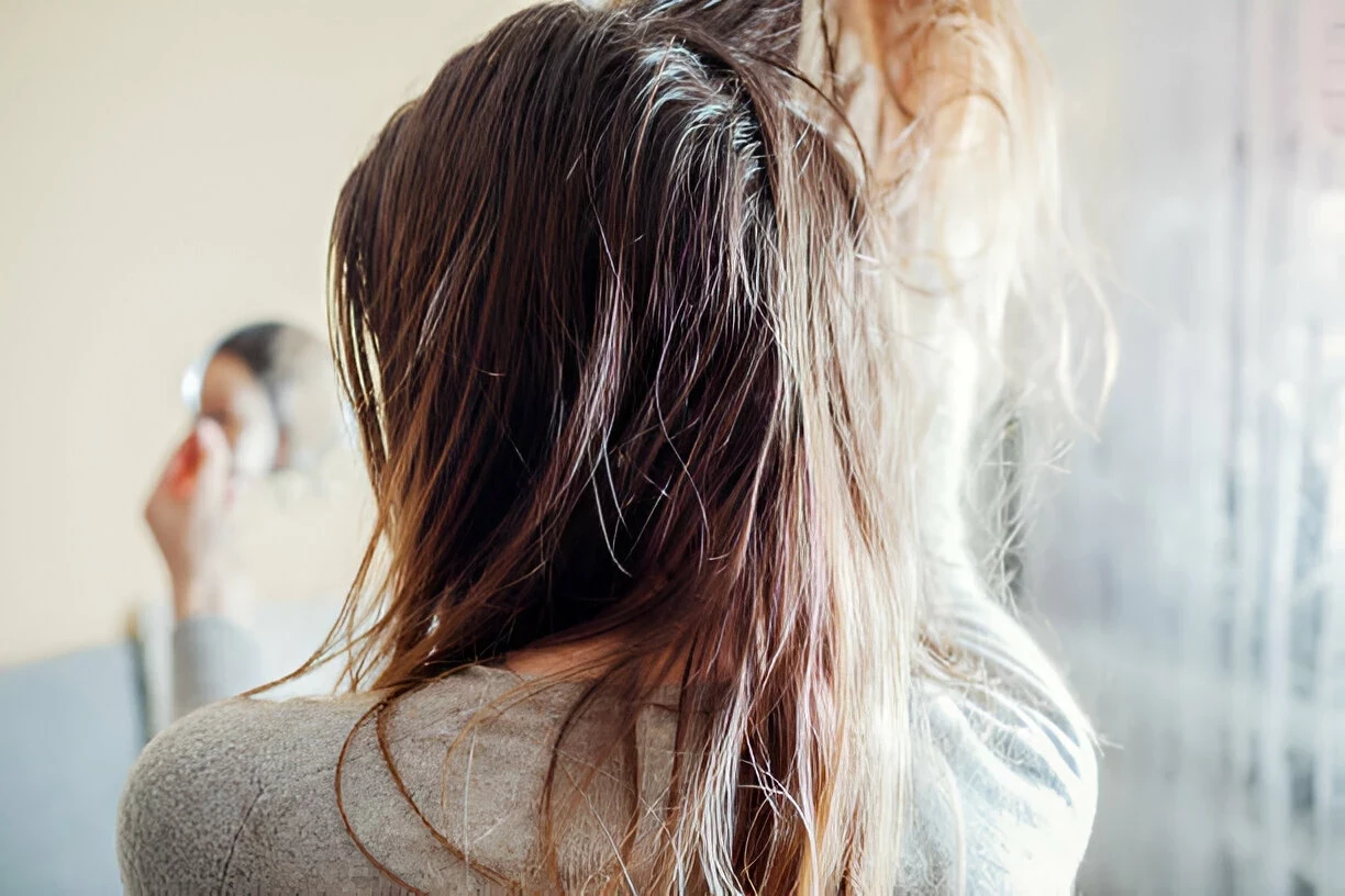 Rambut Berminyak: Penyebab dan Cara Mengatasinya