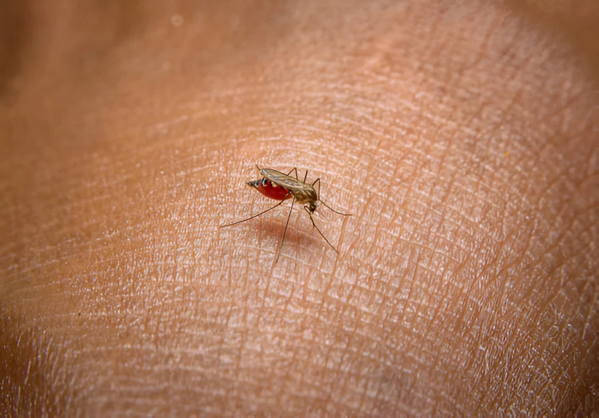 Malaria: Penyebab, Gejala, Serta Cara Mencegah dan Mengobatinya