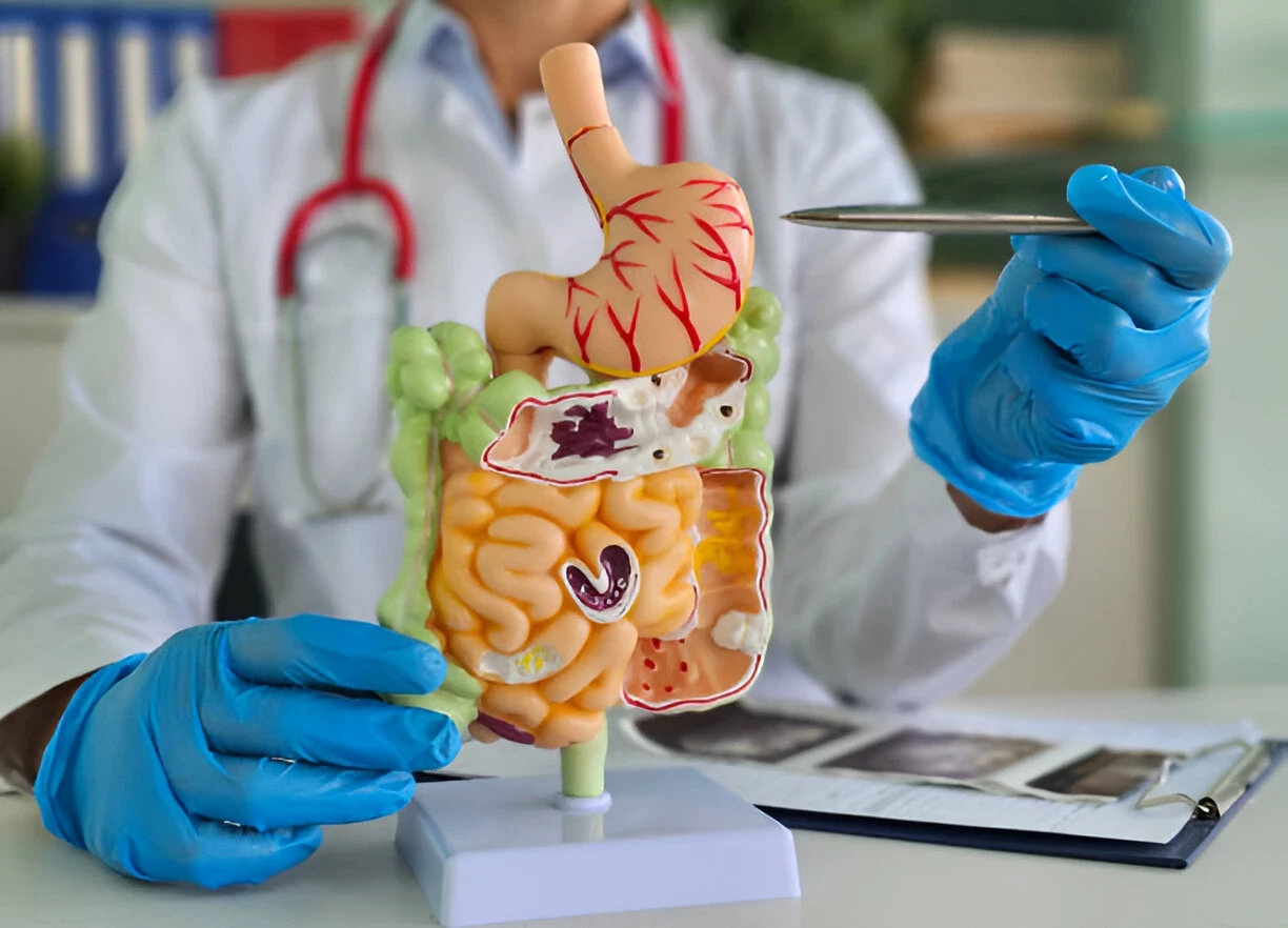 Perforasi Gastrointestinal: Penyebab, Gejala dan Cara Mengatasinya