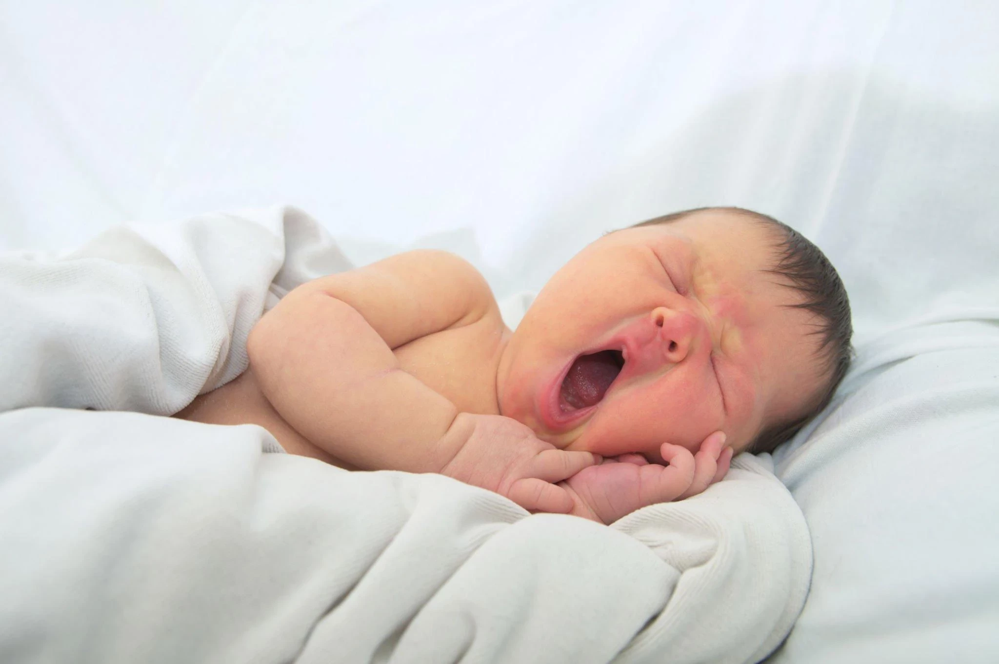 Penyakit Kuning Pada Bayi: Penyebab, Gejala, Pengobatan Yang Tersedia, dan Cara Mencegahnya