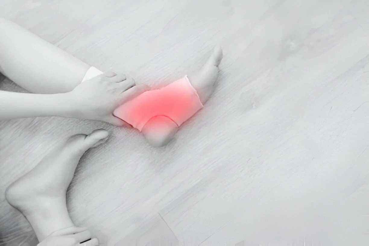 Ruptur Tendon Achilles: Penyebab, Gejala, dan Cara Mengatasinya