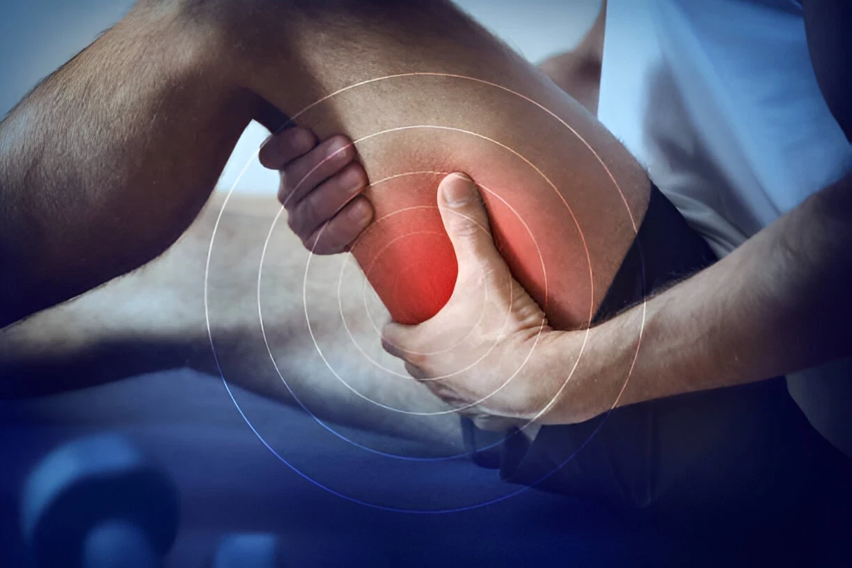 Cedera Hamstring: Penyebab, Gejala, dan Cara Mengatasinya