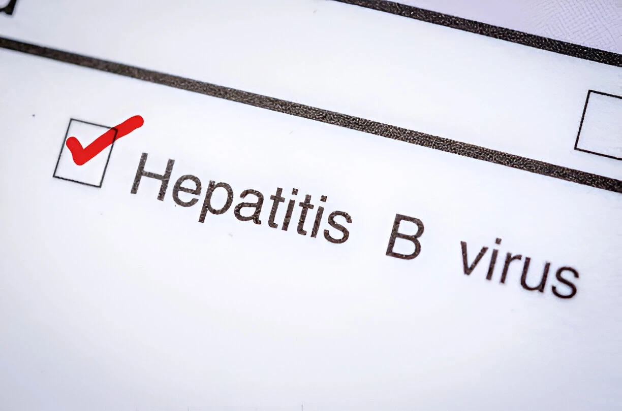 Hepatitis B (HBV): Penyebab, Gejala, Cara Mengobatinya, dan Langkah Pencegahan Yang Dapat Diambil