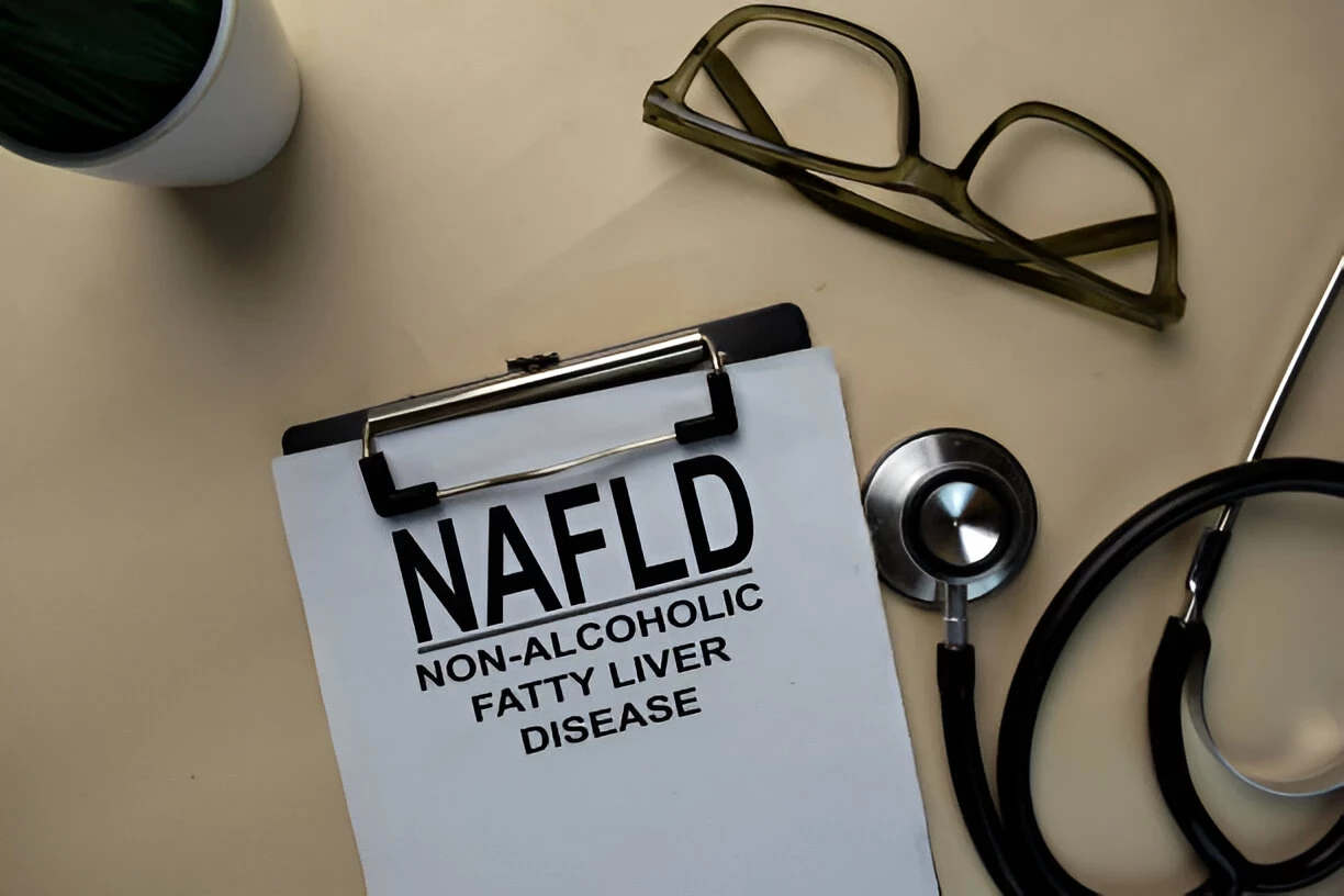Perlemakan Hati Non Alkoholik (NAFLD): Penyebab, Gejala, dan Cara Mencegahnya