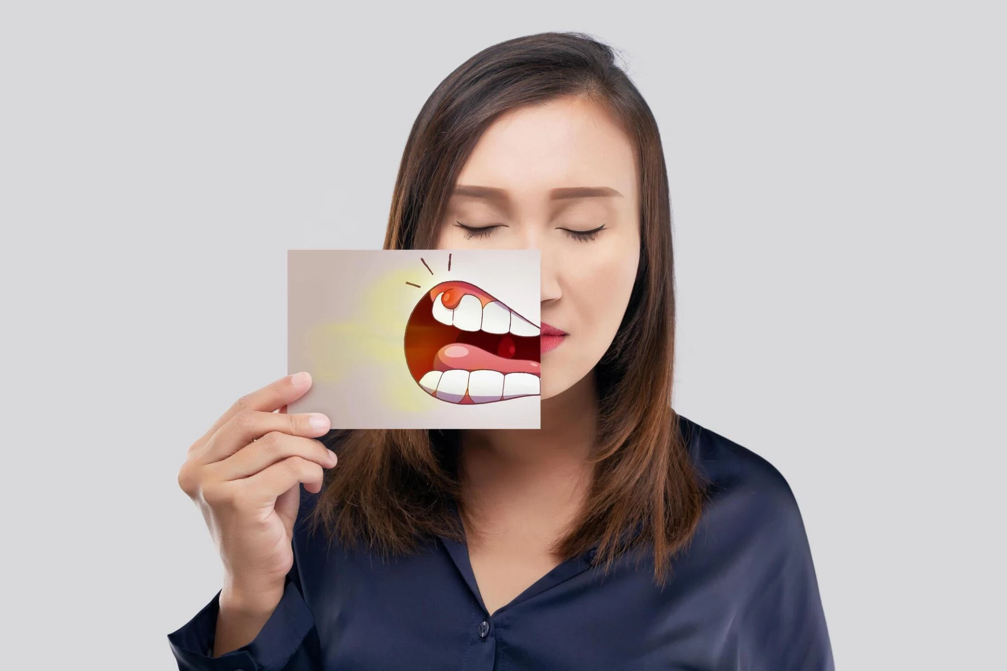Gingivitis: Penyebab, Gejala, Cara Mengatasi, dan Pencegahan