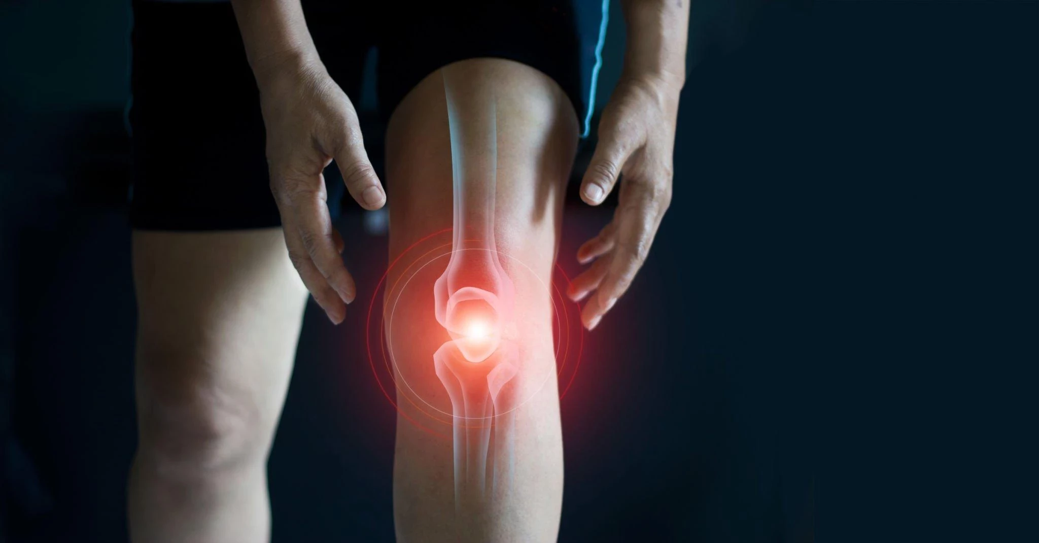 Osteoartritis: Gejala, Penyebab, dan Cara Mengatasinya