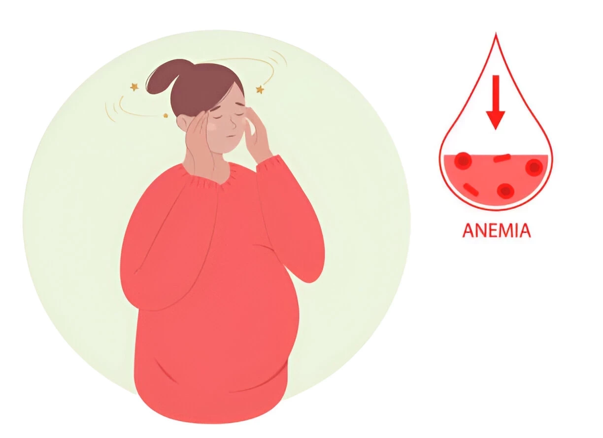 Anemia Pada Ibu Hamil: Ketahui Penyebab, Gejala, Bahayanya dan Cara Mengatasinya