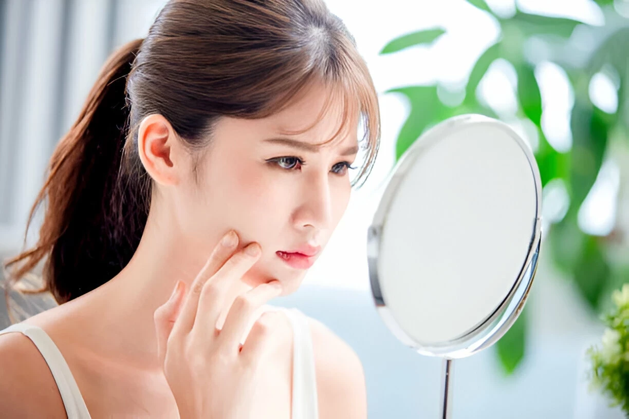 8 Tips Untuk Mengatasi Kulit Yang Tidak Cocok Dengan Skincare