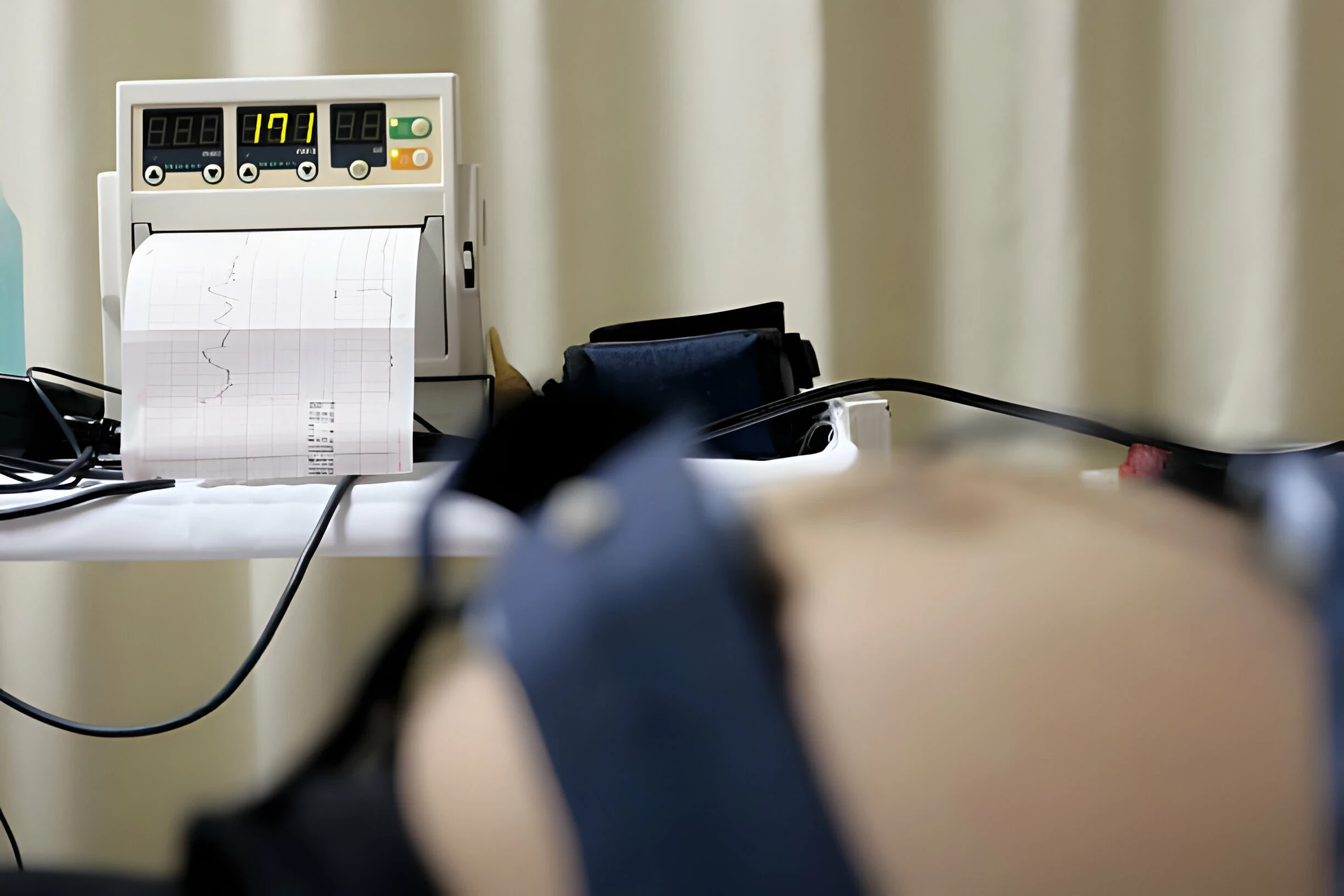 Cardiotocography (CTG) Saat Hamil: Kapan Diperlukan dan Apa yang Dipantau?