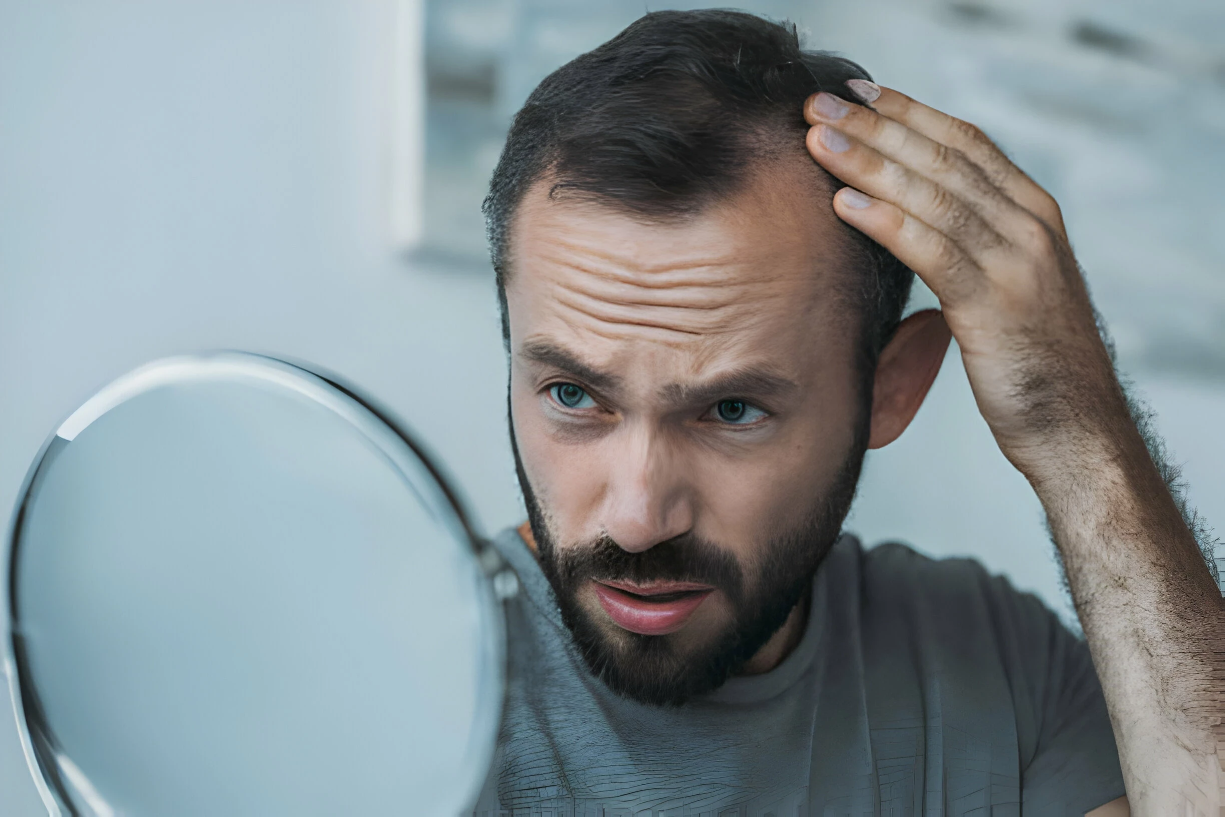 Botak (Alopecia): Penyebab, Gejala, dan Cara Mengatasinya